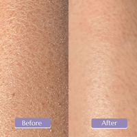 Smooth & Clear — Exfoliating Ingrown Hair Removal Glove  🧤