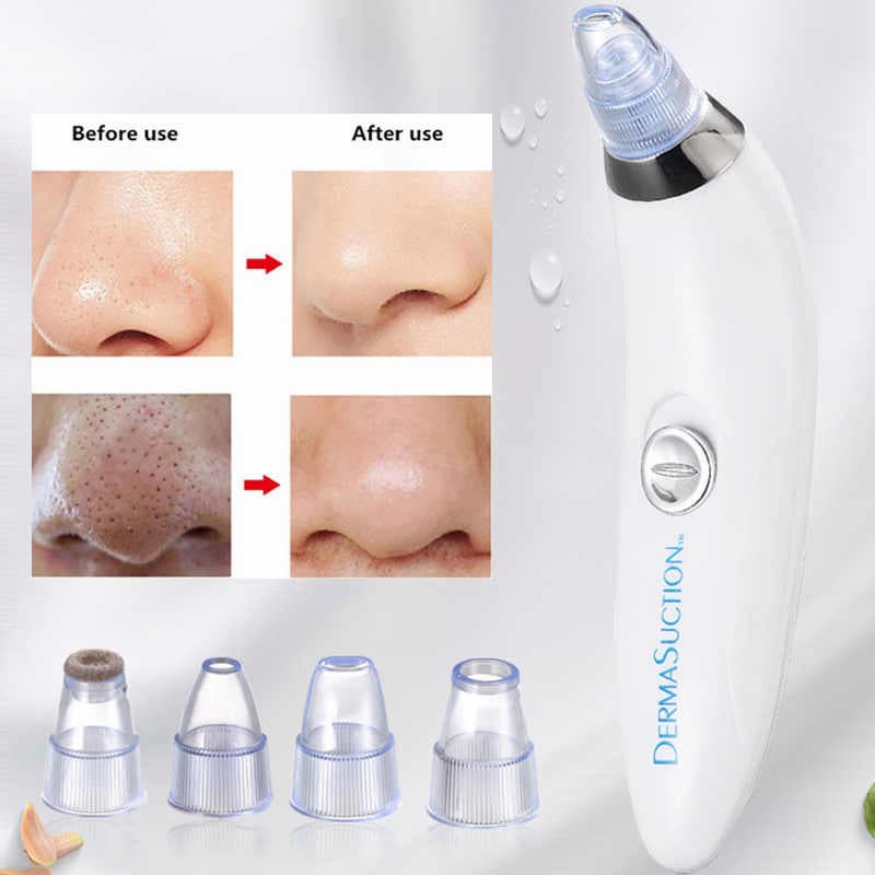 GS DermaGlow™ 5-in-1 Acne & Blackhead Remover Pro